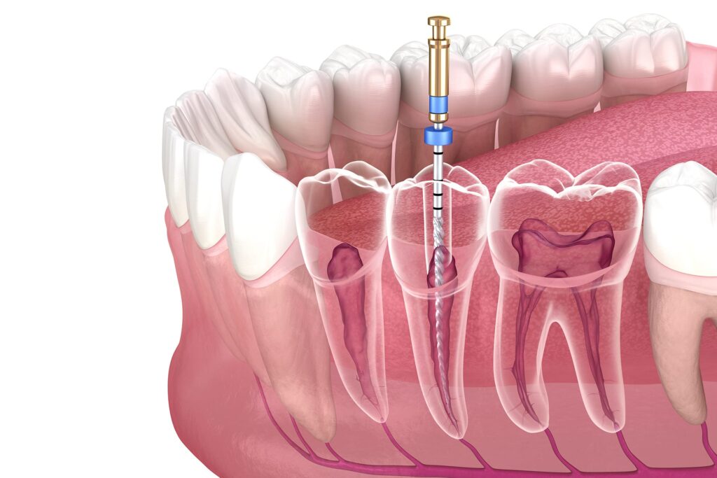 Odontologia Conservadora Hero